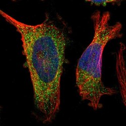 IL-28R alpha/IFN-lambda R1 Antibody, Novus Biologicals:Antibodies:Primary